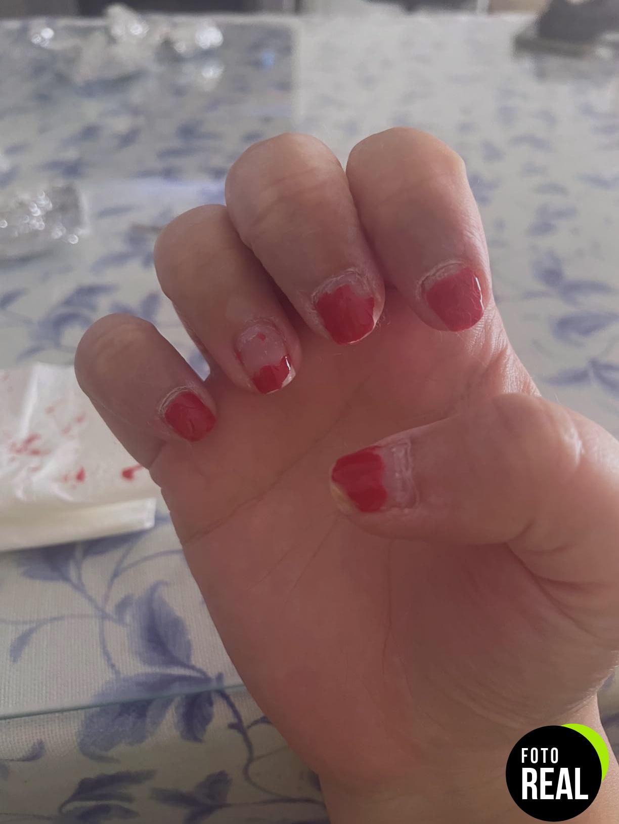 quitar-esmalte-acetona-pura-100-foto-3