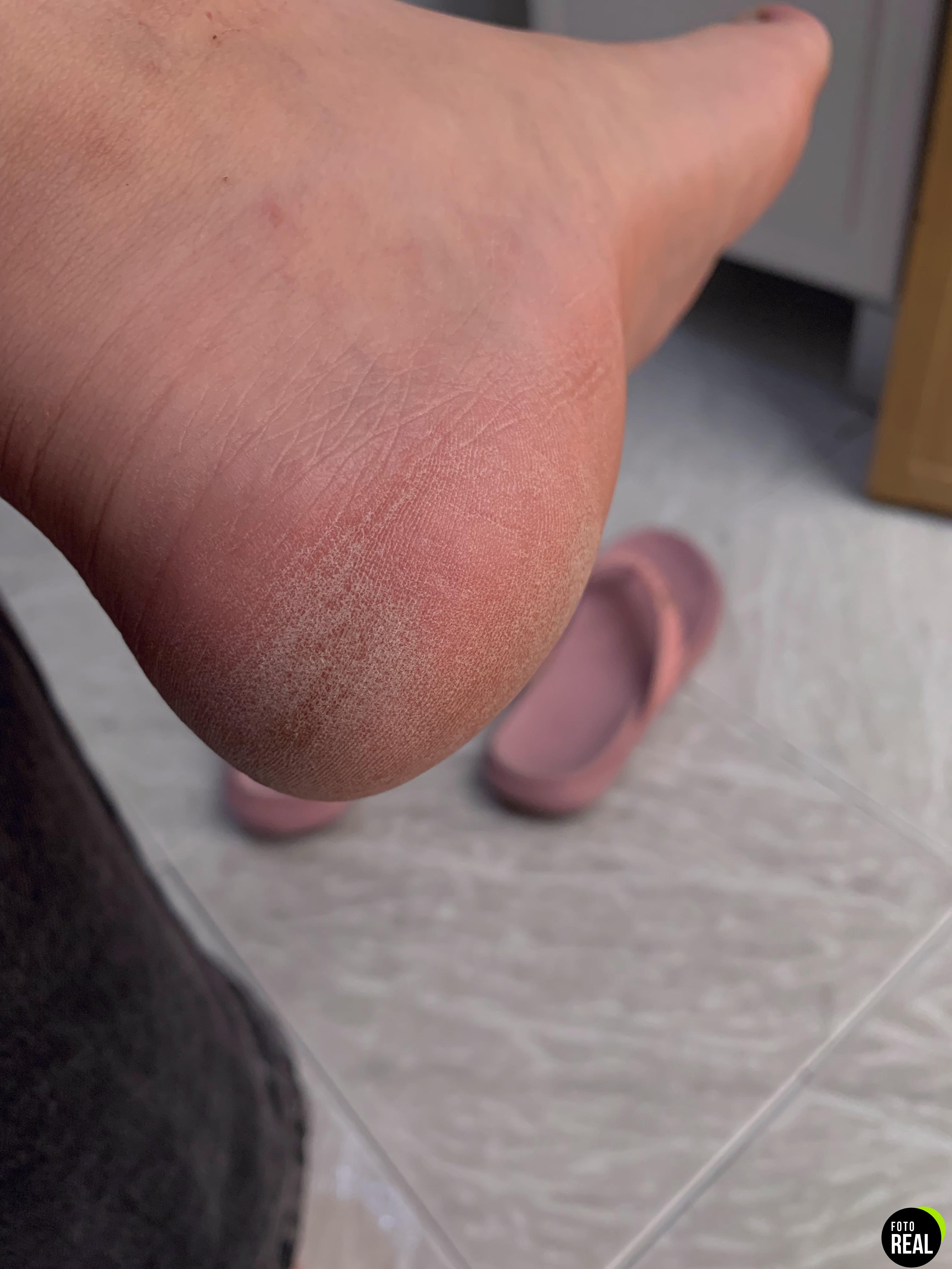scholl-lima-electrica-pies-2en1-morado-foto-3
